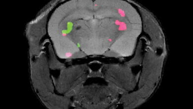מבעד לרקמות: החיים החדשים של סריקות ה-MRI